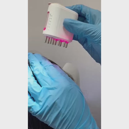 The RESTORED Hair Growth System